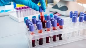 Photo of a rack of multicolored test tubes with a hand in a medical glove reaching to grab one tube