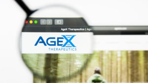 Image of the AgeX Therapeutics (AGE) website under a magnifying glass. 
