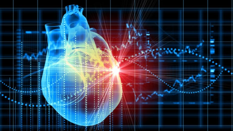 HSCS Stock - Why Is Heart Test (HSCS) Stock Up 135% Today?