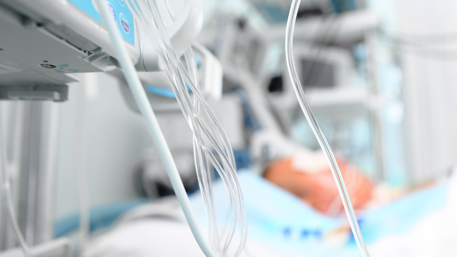 A photograph of various medical tubes attached to equipment in a hospital.