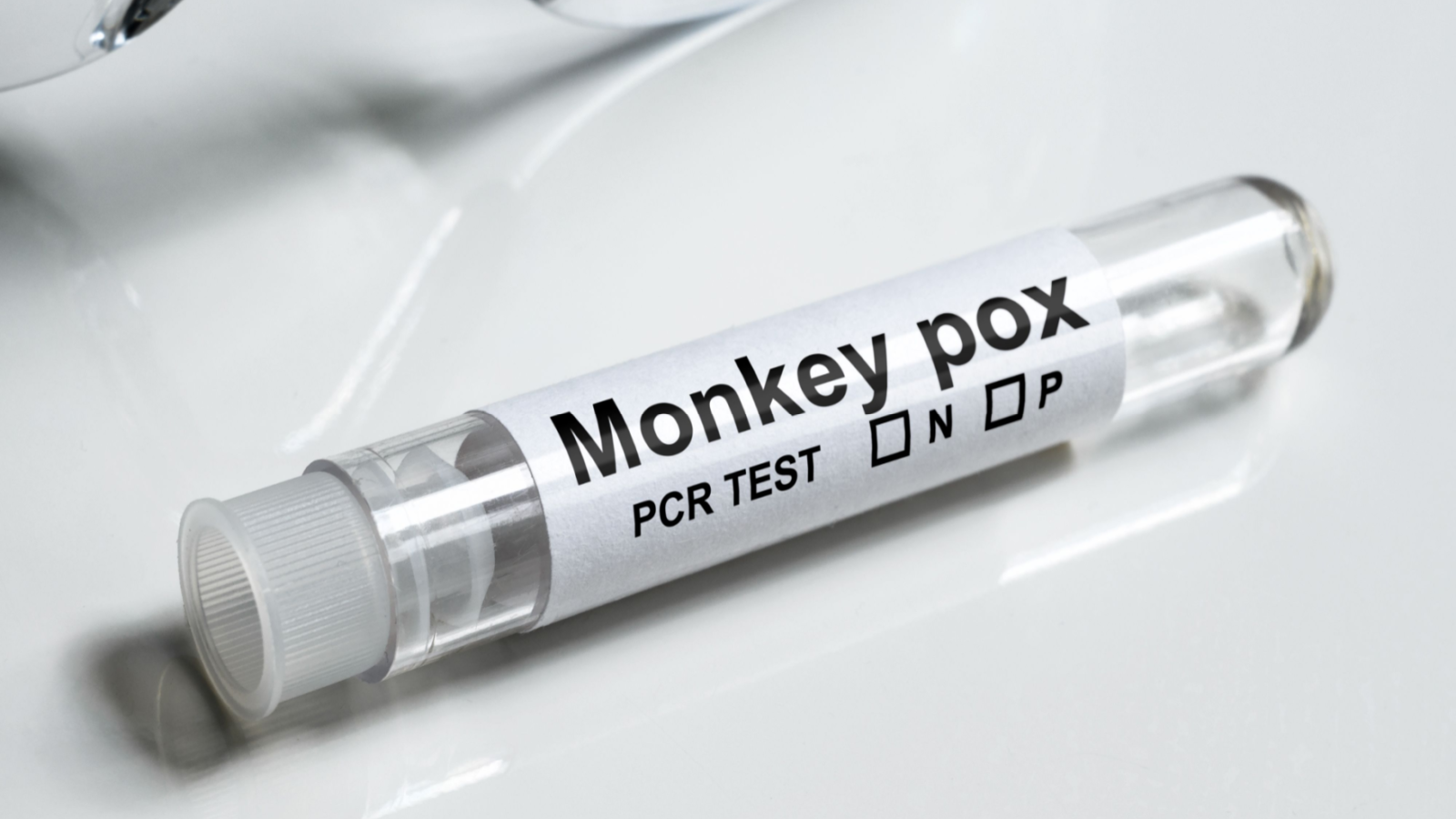 Monkeypox test tube on white table close-up. Medical kit for monkey pox virus diagnostics and smallpox research. Concept of monkeypox, PCR testing, result, science, laboratory, health and cure. WETG Stock