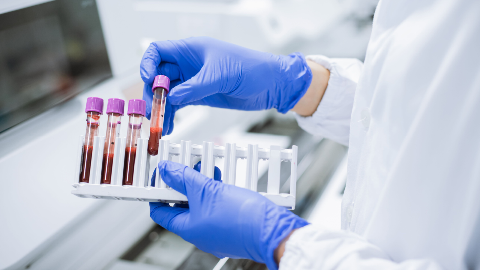 Scientist wearing gloves holding test tube in sample rack to check quality of the sample. TTOO stock